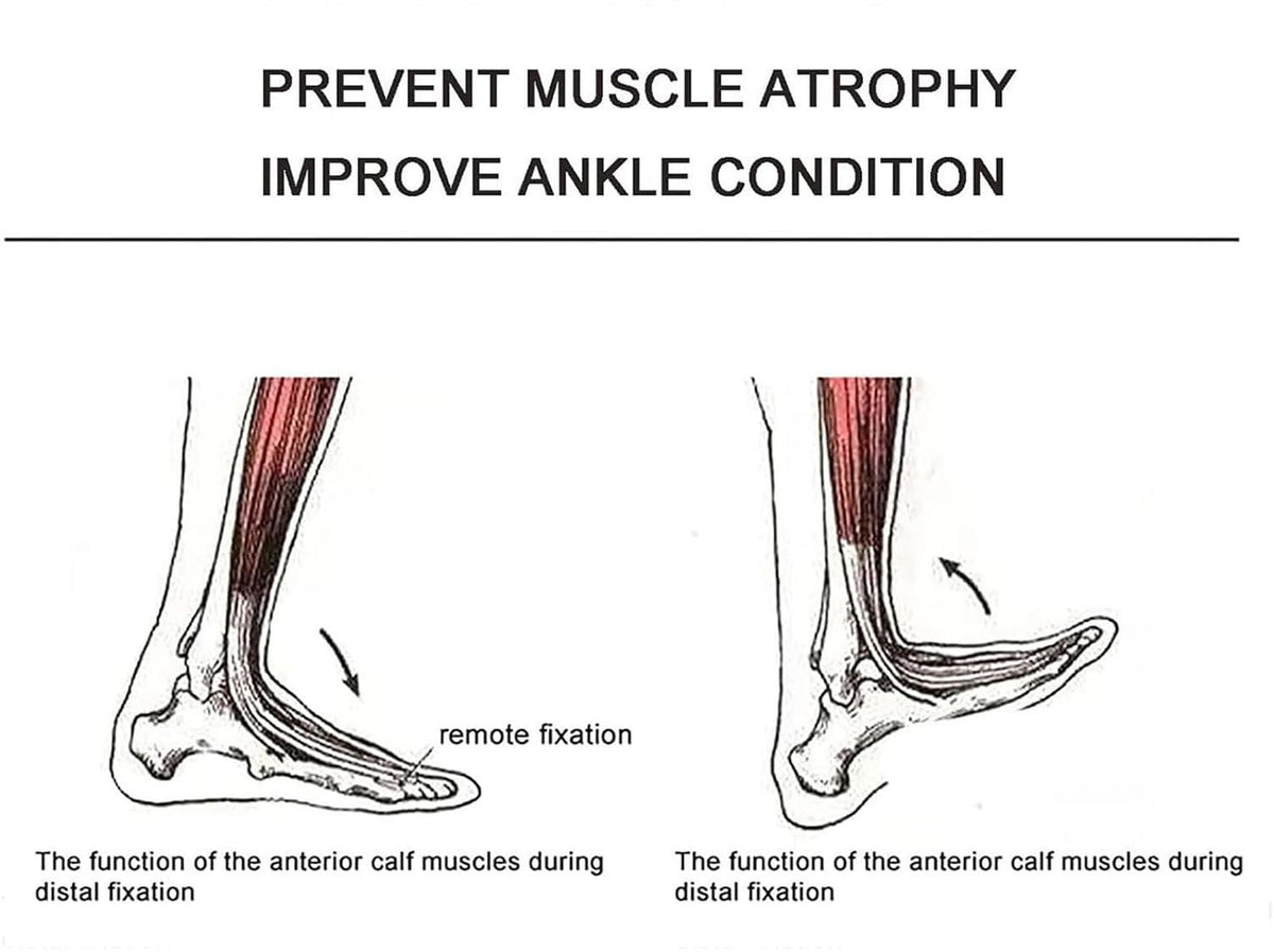 Ankle Joint Rehab Training Equipment,Ankle Post-Operative Trainer,Foot Rehabilitation Training Equipment,Static Stretch Correction Electric